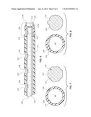 Sacrificial Catheter diagram and image