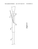 Rapid Exchange Stent Delivery System diagram and image