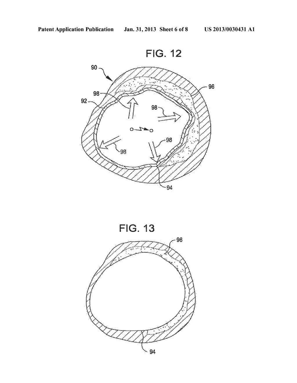 SHOCK WAVE BALLOON CATHETER SYSTEM WITH OFF CENTER SHOCK WAVE GENERATOR - diagram, schematic, and image 07