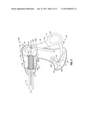 Single Action Tissue Sealer diagram and image