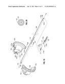 Single Action Tissue Sealer diagram and image