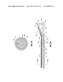 Single Action Tissue Sealer diagram and image