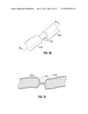 Single Action Tissue Sealer diagram and image