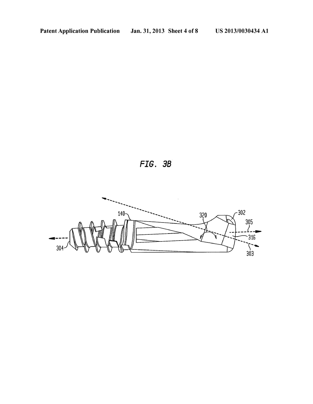 FIXATION SYSTEM, AN INTRAMEDULLARY FIXATION ASSEMBLY AND METHOD OF USE - diagram, schematic, and image 05