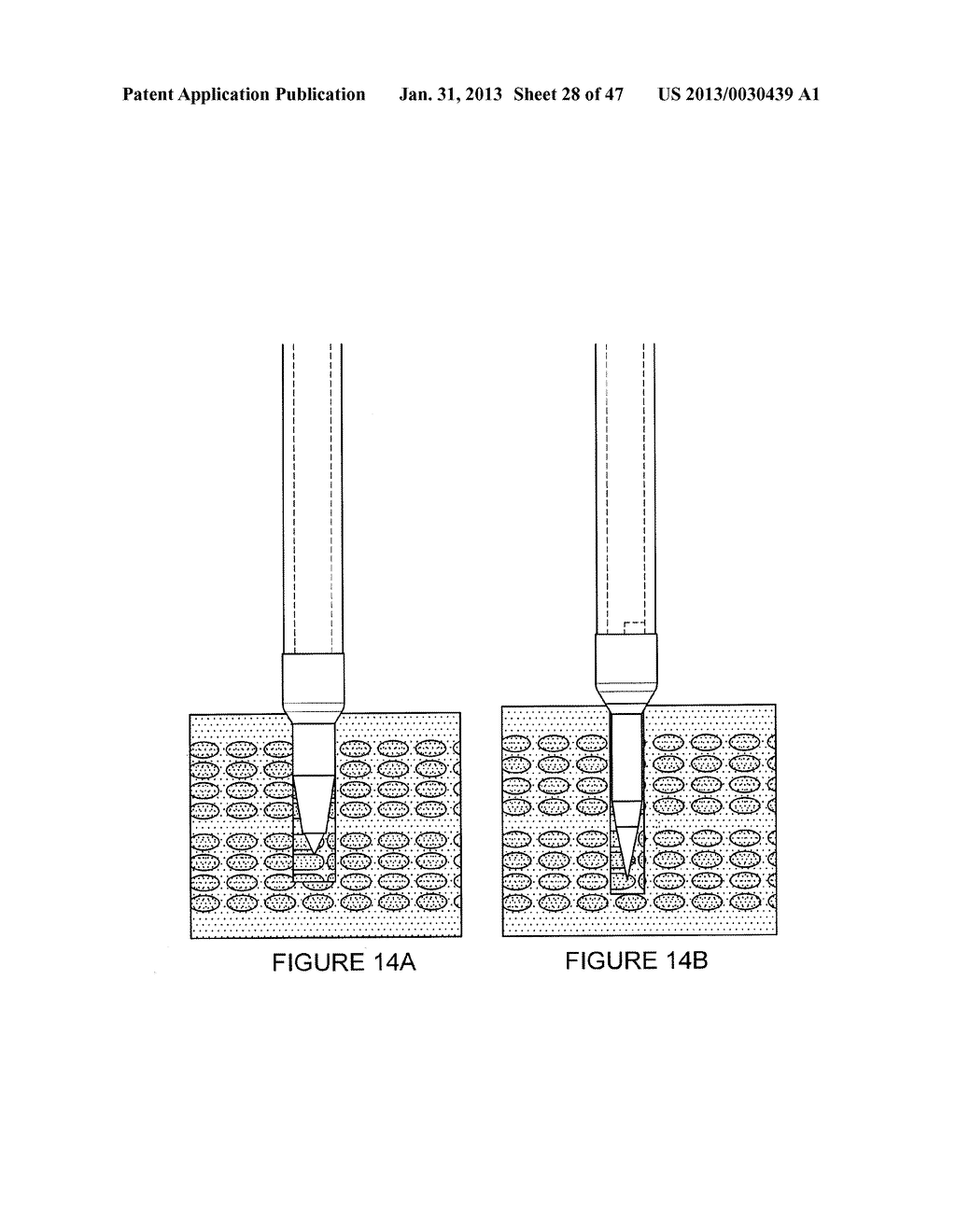 APPARATUS FOR INTRODUCING BONE PORTALS - diagram, schematic, and image 29