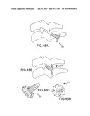 VERTEBRAL JOINT IMPLANTS AND DELIVERY TOOLS diagram and image