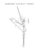 TIBIOTALAR ARTHRODESIS GUIDE diagram and image