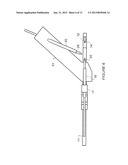 TIBIOTALAR ARTHRODESIS GUIDE diagram and image