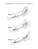 SUTURE TRIMMER diagram and image