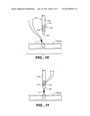 SUTURE TRIMMER diagram and image