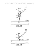 SUTURE TRIMMER diagram and image