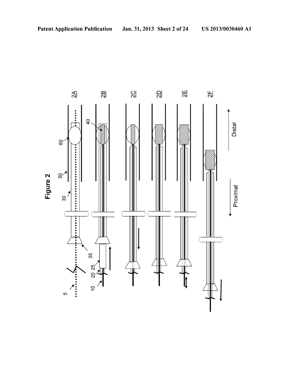 INTRAVASCULAR THROMBOEMBOLECTOMY DEVICE AND METHOD USING THE SAME - diagram, schematic, and image 03