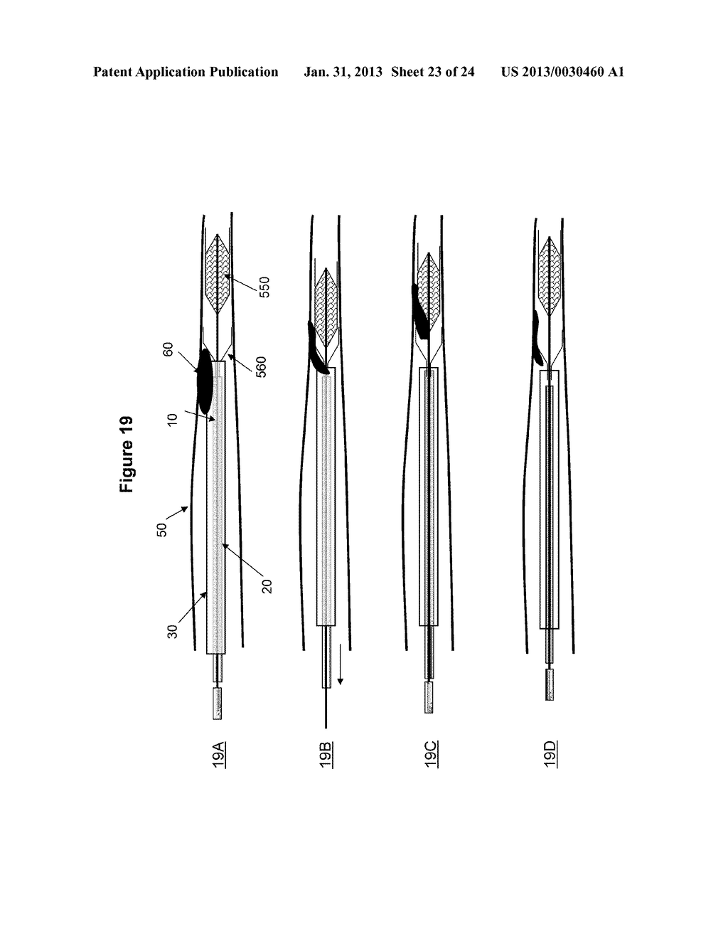 INTRAVASCULAR THROMBOEMBOLECTOMY DEVICE AND METHOD USING THE SAME - diagram, schematic, and image 24