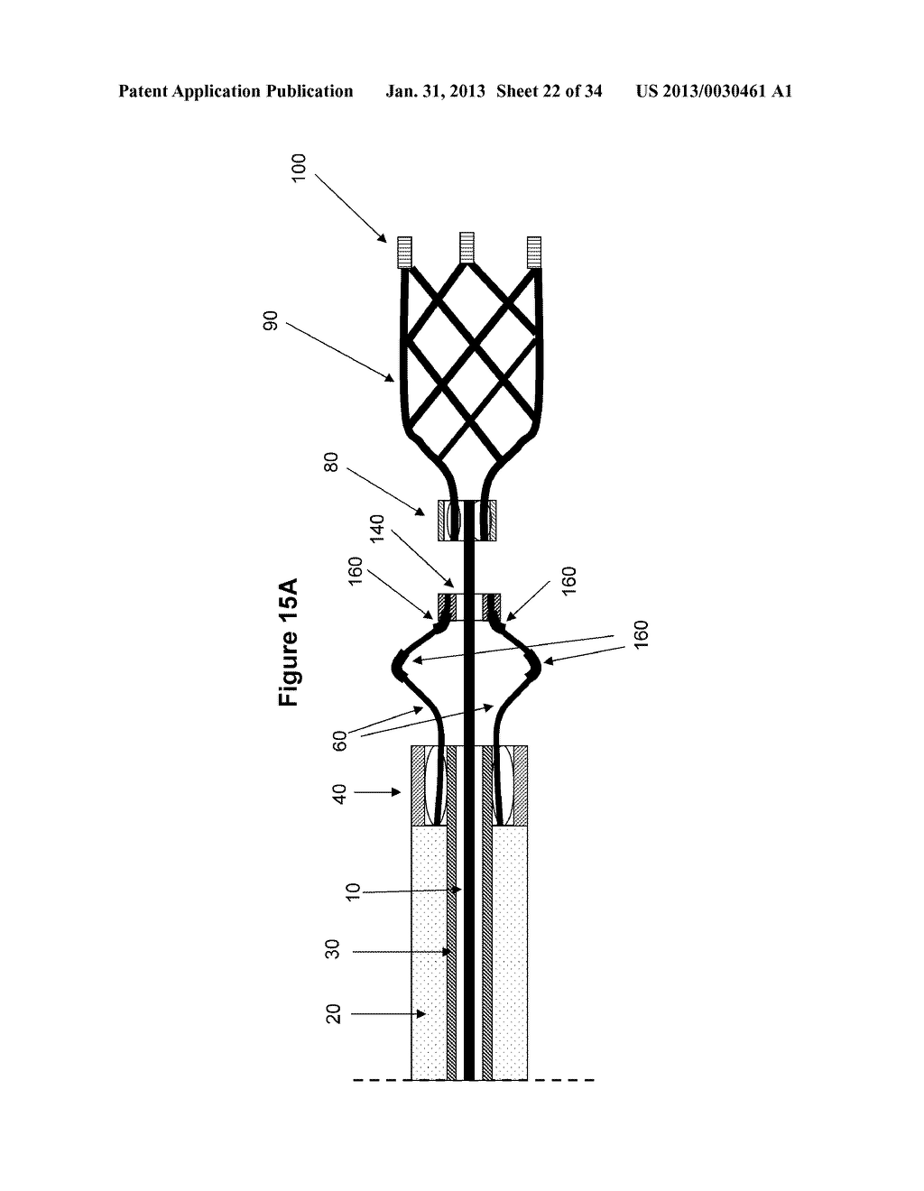 INTRAVASCULAR THROMBOEMBOLECTOMY DEVICE AND METHOD USING THE SAME - diagram, schematic, and image 23