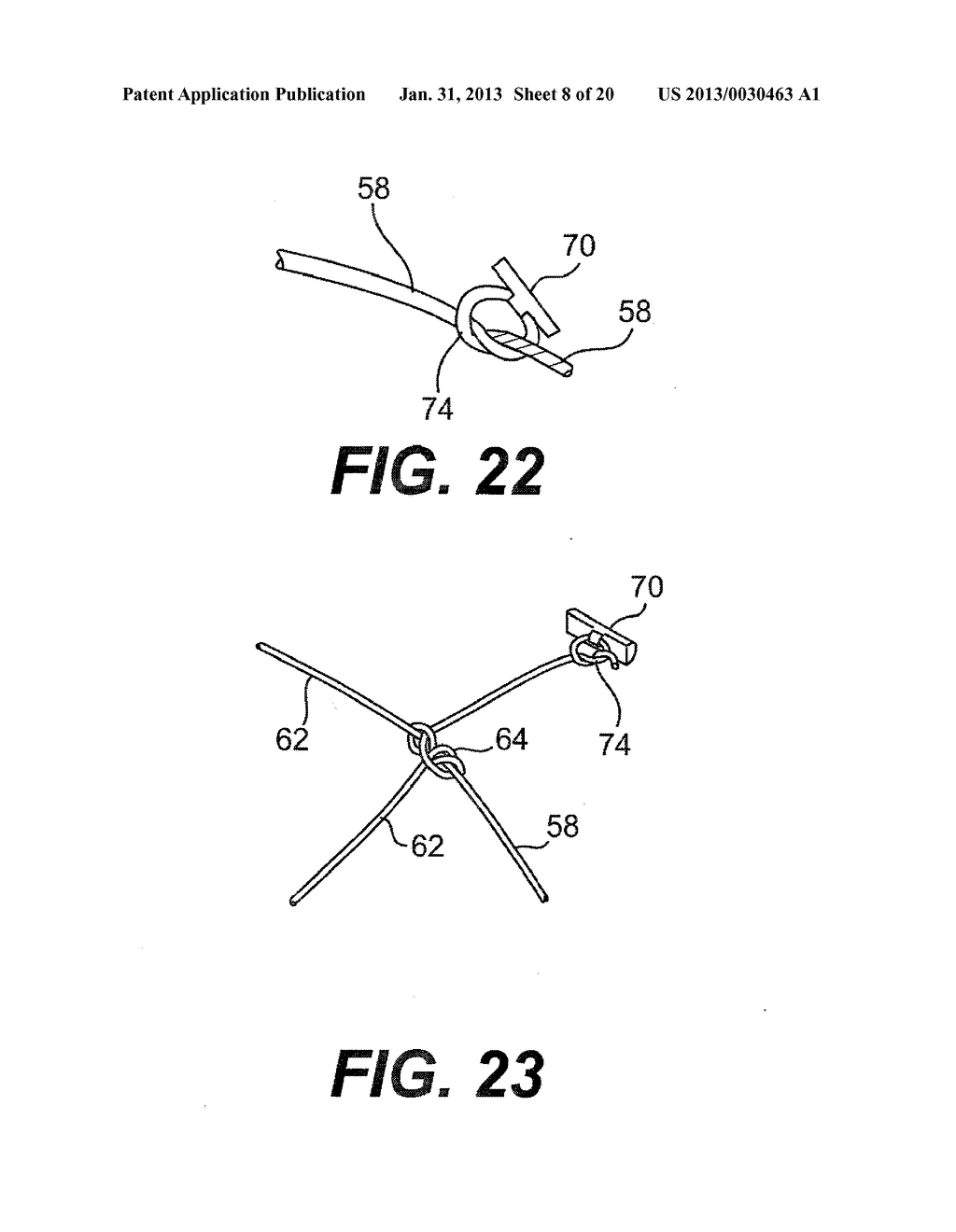 SYSTEM AND METHOD FOR ALL-INSIDE SUTURE FIXATION FOR IMPLANT ATTACHMENT     AND SOFT TISSUE REPAIR - diagram, schematic, and image 09