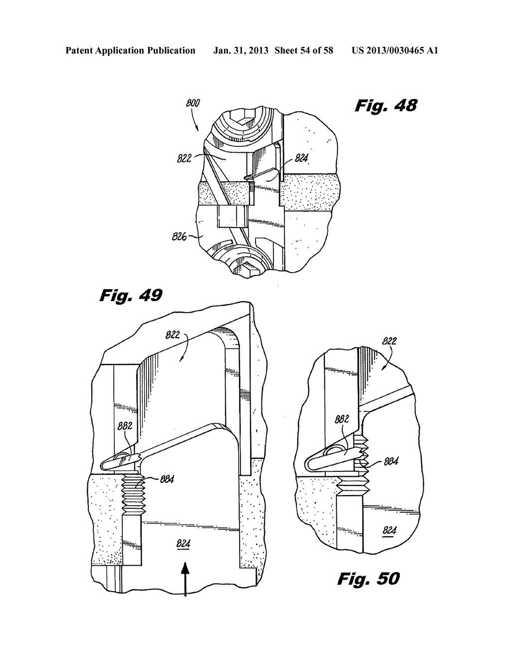 BONE PLATE ASSEMBLY WITH BONE SCREW RETENTION FEATURES - diagram, schematic, and image 55