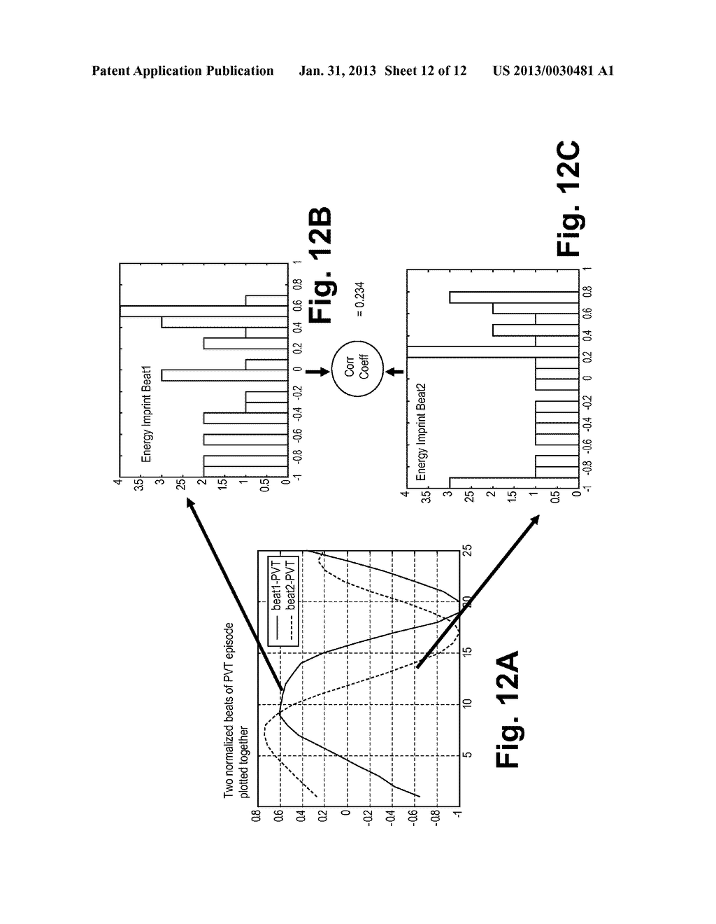 MORPHOLOGY-BASED DISCRIMINATION ALGORITHM BASED ON RELATIVE AMPLITUDE     DIFFERENCES AND CORRELATION OF IMPRINTS OF ENERGY DISTRIBUTION - diagram, schematic, and image 13