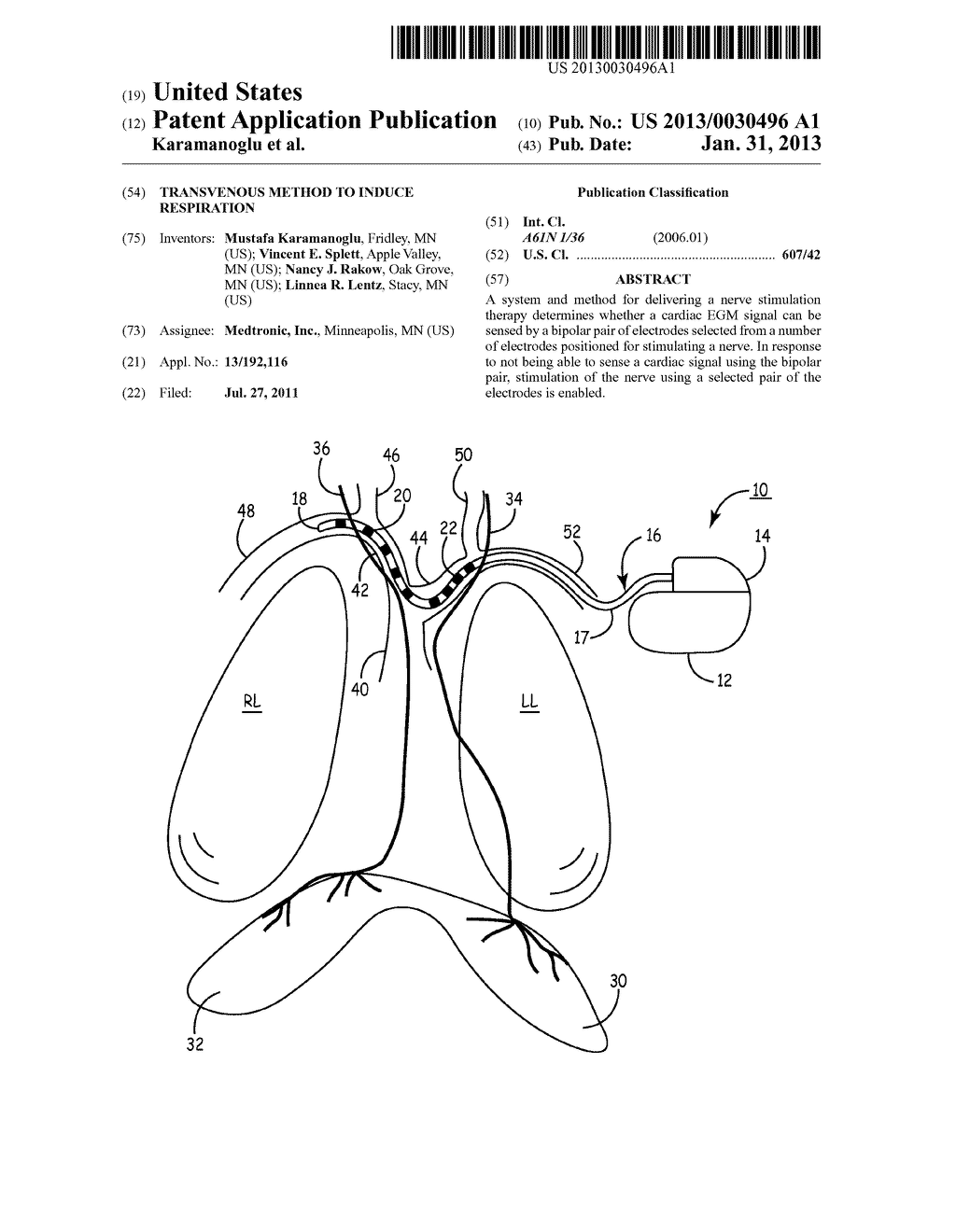 TRANSVENOUS METHOD TO INDUCE RESPIRATION - diagram, schematic, and image 01