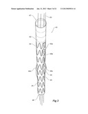 Introducer With Extension diagram and image