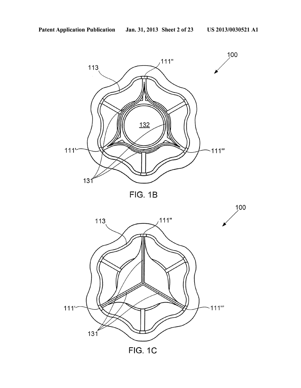 DEVICES FOR REDUCING LEFT ATRIAL PRESSURE HAVING BIODEGRADABLE     CONSTRICTION, AND METHODS OF MAKING AND USING SAME - diagram, schematic, and image 03