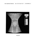 DEVICES FOR REDUCING LEFT ATRIAL PRESSURE HAVING BIODEGRADABLE     CONSTRICTION, AND METHODS OF MAKING AND USING SAME diagram and image