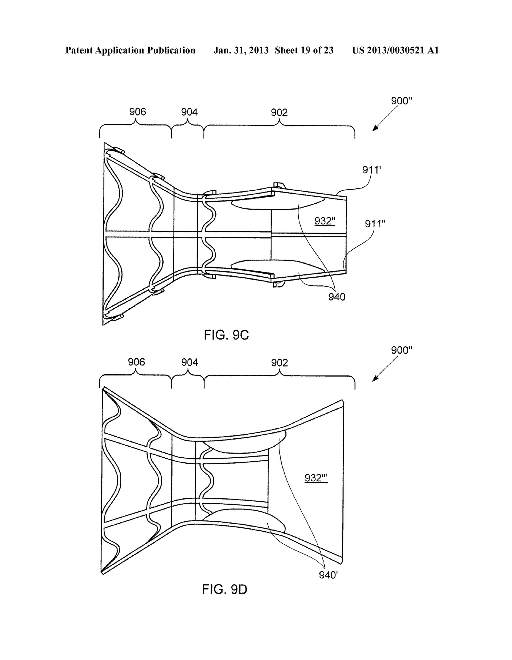 DEVICES FOR REDUCING LEFT ATRIAL PRESSURE HAVING BIODEGRADABLE     CONSTRICTION, AND METHODS OF MAKING AND USING SAME - diagram, schematic, and image 20