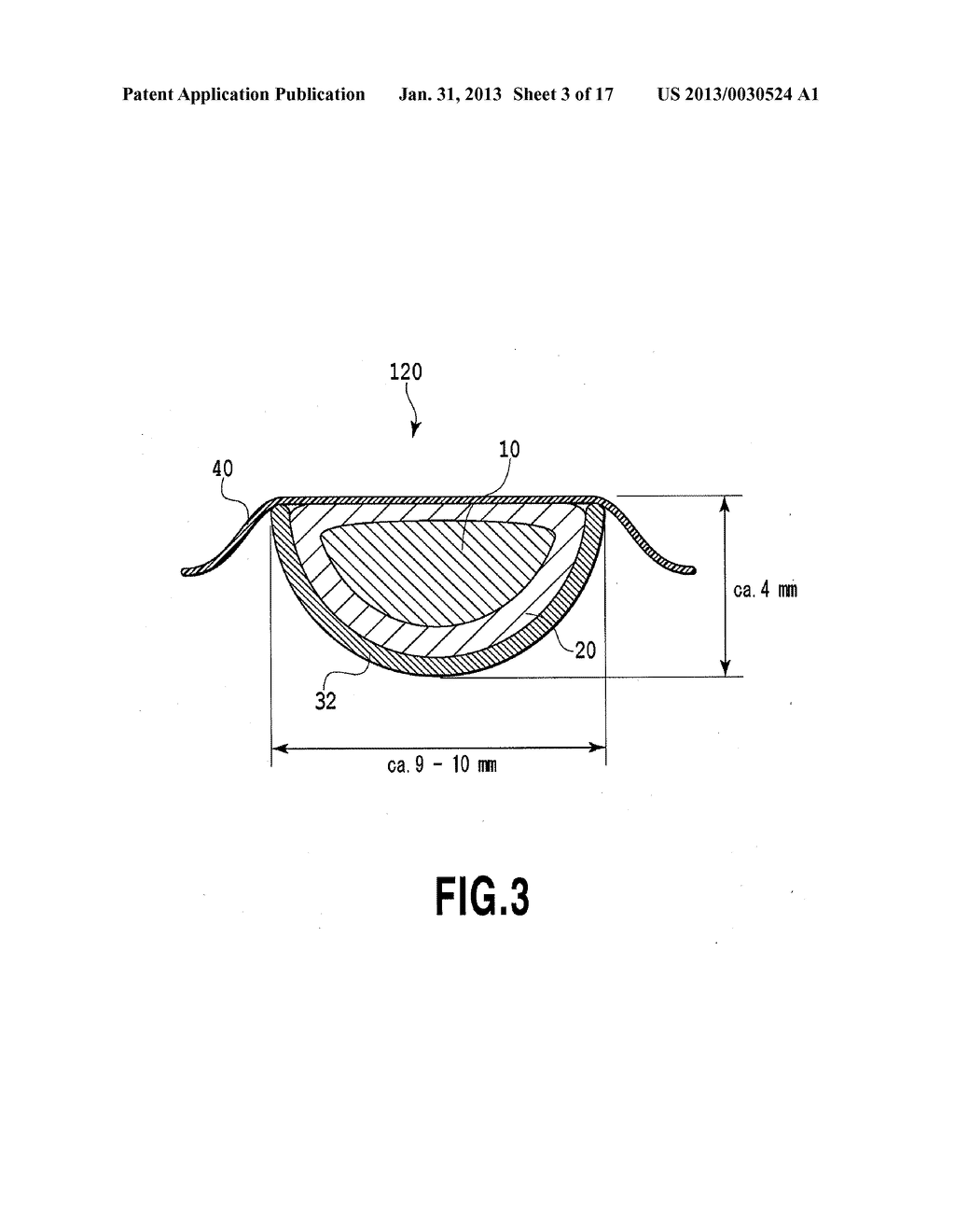 ARTIFICIAL LENS FOR CATARACT SURGERY PRACTICE - diagram, schematic, and image 04