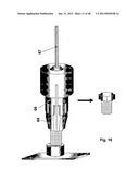 Implantation of Cartilage diagram and image