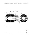 Implantation of Cartilage diagram and image