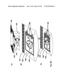 Implantation of Cartilage diagram and image