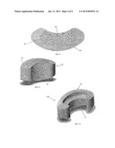 Radiolucent Spinal Fusion Cage diagram and image