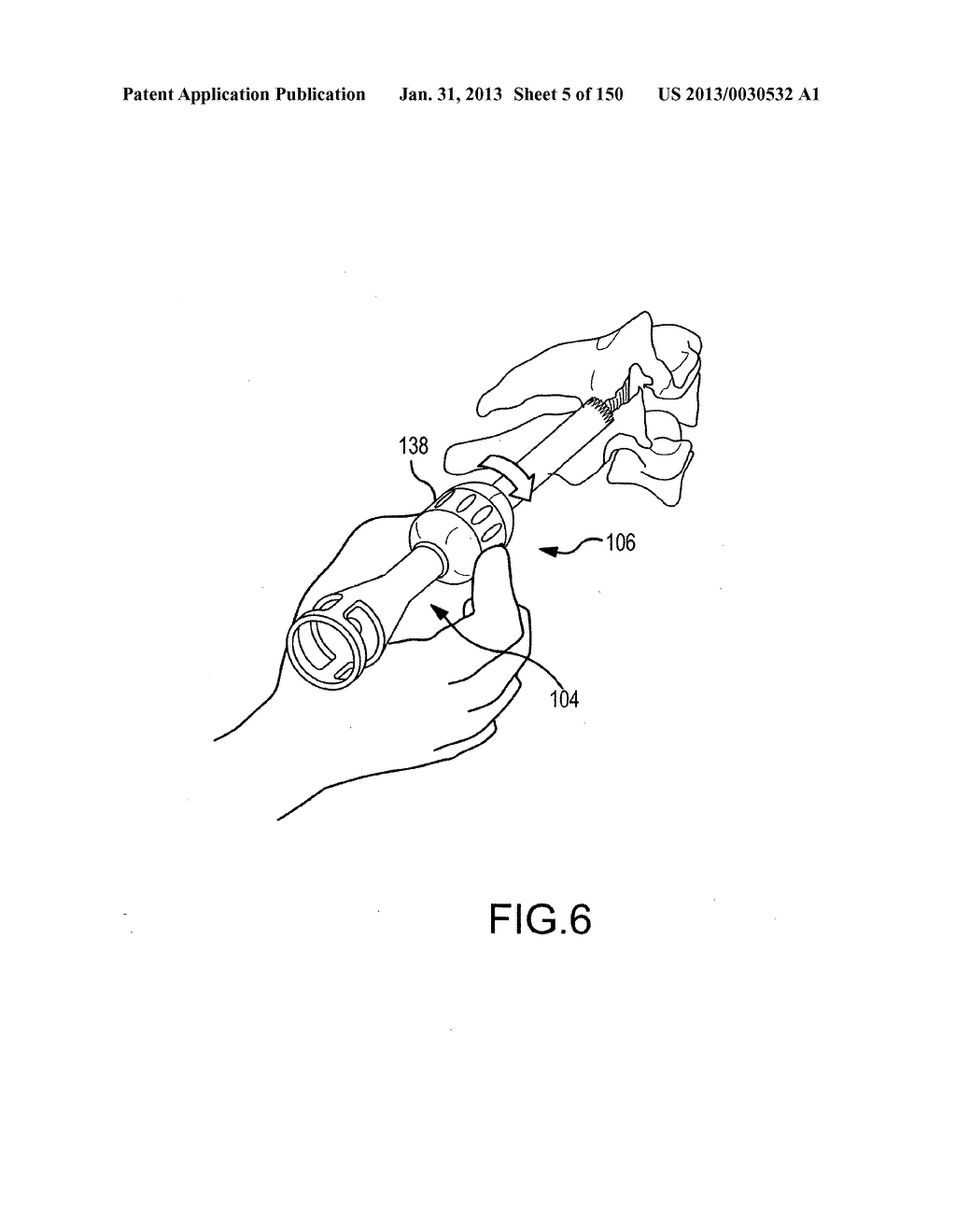 VERTEBRAL JOINT IMPLANTS AND DELIVERY TOOLS - diagram, schematic, and image 06