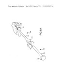 VERTEBRAL JOINT IMPLANTS AND DELIVERY TOOLS diagram and image