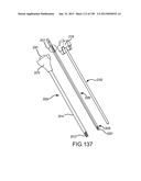 VERTEBRAL JOINT IMPLANTS AND DELIVERY TOOLS diagram and image