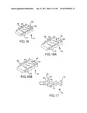 VERTEBRAL JOINT IMPLANTS AND DELIVERY TOOLS diagram and image