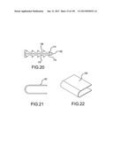 VERTEBRAL JOINT IMPLANTS AND DELIVERY TOOLS diagram and image