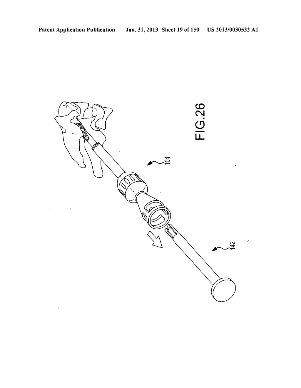 VERTEBRAL JOINT IMPLANTS AND DELIVERY TOOLS - diagram, schematic, and image 20