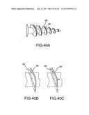 VERTEBRAL JOINT IMPLANTS AND DELIVERY TOOLS diagram and image