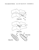 VERTEBRAL JOINT IMPLANTS AND DELIVERY TOOLS diagram and image