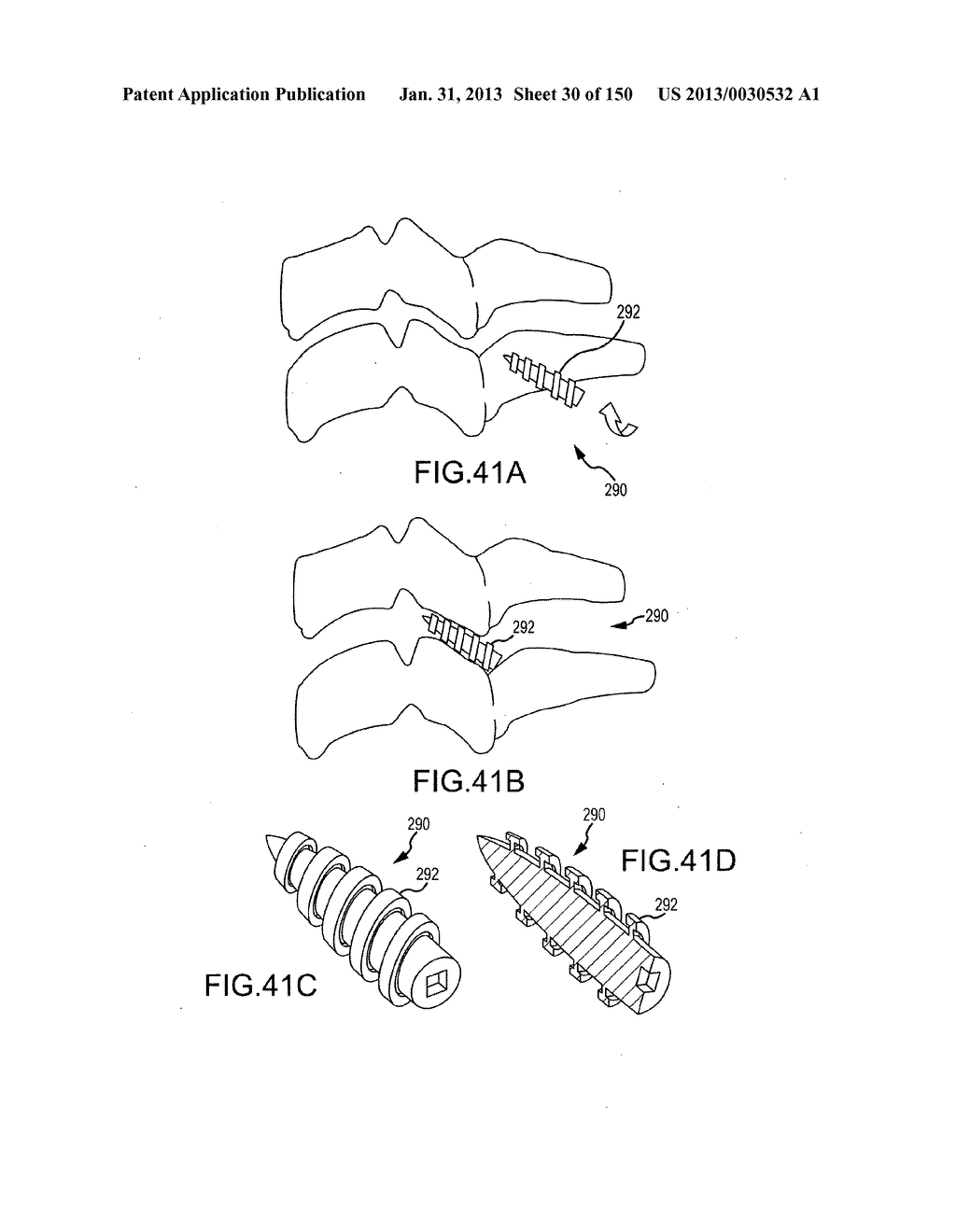 VERTEBRAL JOINT IMPLANTS AND DELIVERY TOOLS - diagram, schematic, and image 31