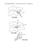 VERTEBRAL JOINT IMPLANTS AND DELIVERY TOOLS diagram and image