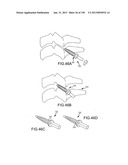 VERTEBRAL JOINT IMPLANTS AND DELIVERY TOOLS diagram and image