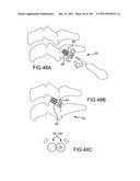 VERTEBRAL JOINT IMPLANTS AND DELIVERY TOOLS diagram and image