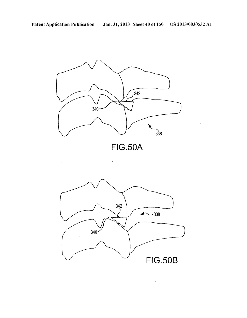 VERTEBRAL JOINT IMPLANTS AND DELIVERY TOOLS - diagram, schematic, and image 41