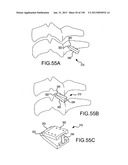 VERTEBRAL JOINT IMPLANTS AND DELIVERY TOOLS diagram and image