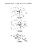 VERTEBRAL JOINT IMPLANTS AND DELIVERY TOOLS diagram and image