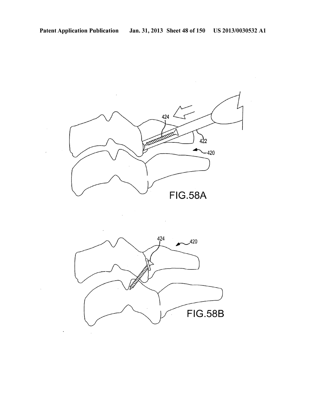 VERTEBRAL JOINT IMPLANTS AND DELIVERY TOOLS - diagram, schematic, and image 49