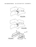 VERTEBRAL JOINT IMPLANTS AND DELIVERY TOOLS diagram and image