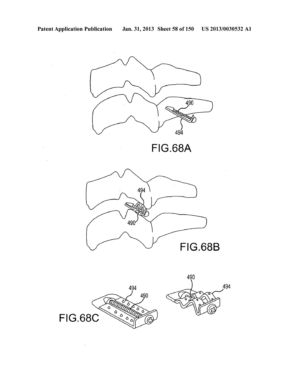 VERTEBRAL JOINT IMPLANTS AND DELIVERY TOOLS - diagram, schematic, and image 59