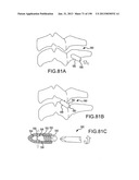 VERTEBRAL JOINT IMPLANTS AND DELIVERY TOOLS diagram and image